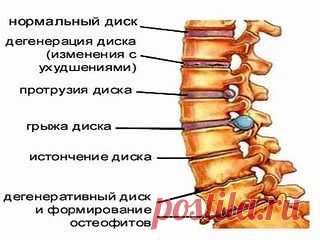 Жалобы при болях отдельных позвоночников и что это означает