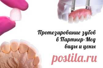 Протезирование зубов: Цены, виды, в Санкт-Петербург Протезирование зубов: винирами, коронками, люминирами, вкладками. || Санкт-Петербург