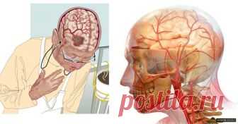 3 самых мощных рецепта для улучшения кровообращения в головном мозге! - Green Medic Понравился пост? Жми лайк и расскажи друзьям! :)
