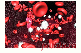 Anemia - a description and symptoms