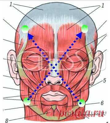Диагональное сшивание мышц лица - Бенита Кантиени
