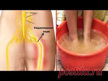 Волшебный рецепт кто страдает защемлением седалищного нерва. Возможен эффект после первой процедуры!