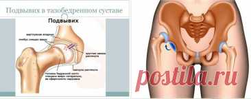 Хотите восстановить тазобедренные суставы? Подберите гармоничные упражнения для передних и задних мышц бедер | Причины Здоровья | Дзен
