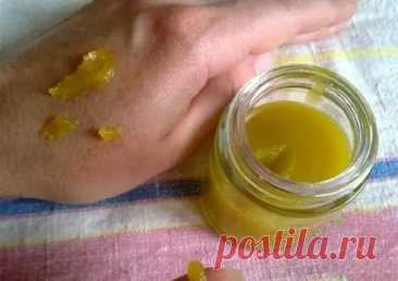 АРТРОЗ ПОБЕЖДЁН?!