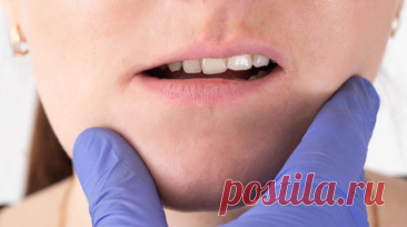 Ортодонт Буторина назвала нарушение прикуса причиной щелчков в челюсти. Врач-ортодонт, амбассадор EUROKAPPA Academy Ирина Буторина рассказала, что к появлению щелчков в челюсти может приводить нарушение прикуса. Читать далее