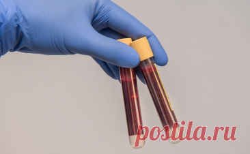 Что нужно есть для здоровья крови Ваше самочувствие напрямую зависит от здоровья крови. Доставить клеткам тела живительный кислород, избавить их от шлаков и углекислого газа – она выполняет...