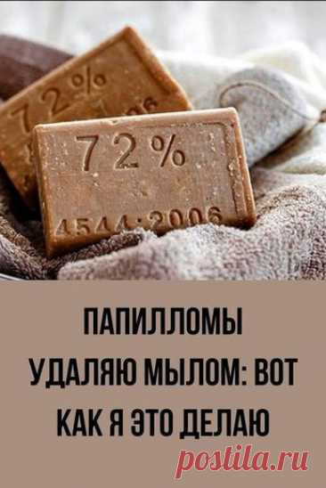 Как удалить папилломы хозяйственным мылом - Женский калейдоскоп