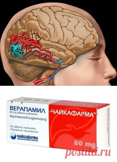 Сосудорасширяющие сосуды головного мозга. Сосудорасширяющие таблетки для головного мозга. Лекарство для сосудов головного мозга. Таблетки для сосудов головного мозга. Таблетки для кровоснабжения мозга.