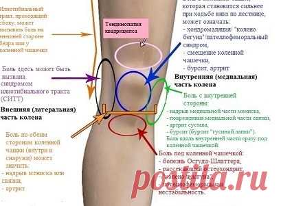 Почему болят суставы: причины