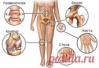 О чем трещат суставы? | КРАСОТА И ЗДОРОВЬЕ