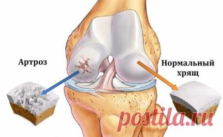 Это скрывали все хирурги! Так лечатся суставы дома за сутки | Naget.Su