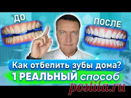 Как отбелить зубы в домашних условиях?  РЕАЛЬНЫЙ способ отбеливания зубов дома своими руками.