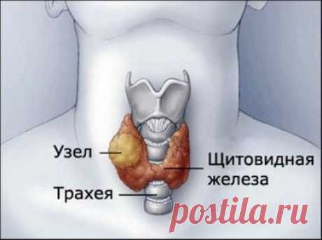 Лучшие рецепты народной медицины от болезни щитовидной железы