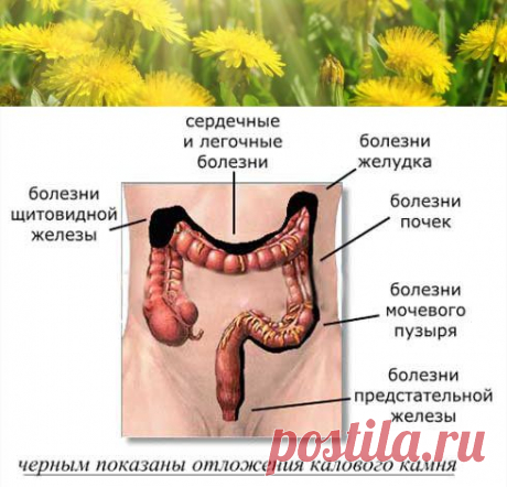 Народная медицина для очищения кишечника | Правила здоровья и долголетия