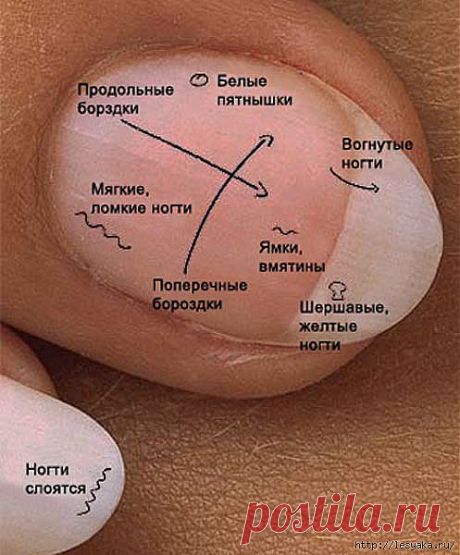 Что говорят ногти о нашем здоровье.