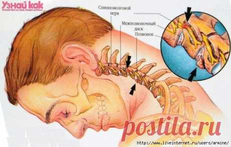 Если у вас болит шея..