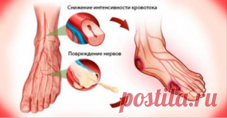 Избавься от плохого кровообращения всего за 20 минут! Применяй лучшие 9 способов Не трать времени зря, начинай прямо сейчас!