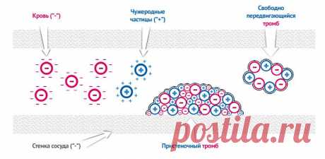 Электронная методика &quot;Персональный флеболог&quot; (варикоз)