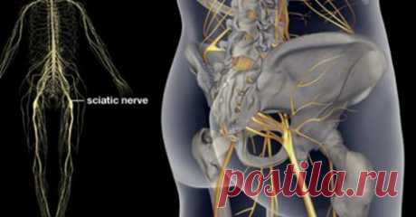 3 упражнения для лечения боли седалищного нерва, бедер и спины