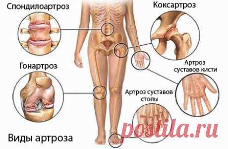 КАК ВЕРНУТЬ СУСТАВАМ МОЛОДОСТЬ: ПРОСТОЙ СПОСОБ В ДОМАШНИХ УСЛОВИЯХ

Запомните простую истину, и никого не слушайте: суставы поддаются лечению всегда, даже в самой глубокой старости! 
читать полностью в источнике...