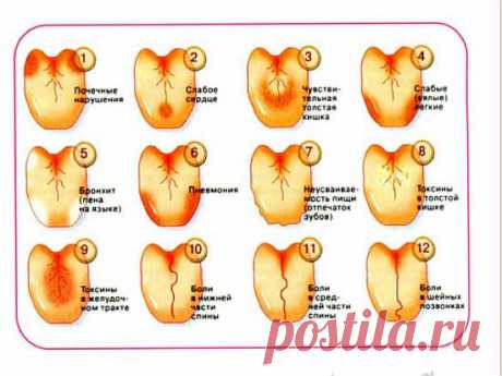 Как по языку узнать о сбоях в работе позвоночника, желудка, печени и предотвратить их?