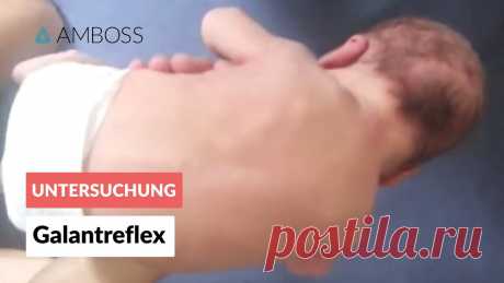 Galantreflex - Frühkindliche Reflexe - AMBOSS Video AMBOSS, Wissen – von Medizinern für Mediziner. https://www.amboss.com/de Im Rahmen der Kindervorsorgeuntersuchungen U2 und U3 werden standardmäßig auch die N...