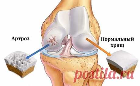 Это скрывали все хирурги! Так лечатся суставы дома за сутки