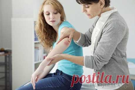 Псориаз – одна из загадочных болезней в дерматологии