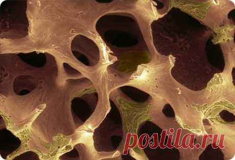 Как принимать яичную скорлупу при остеопорозе