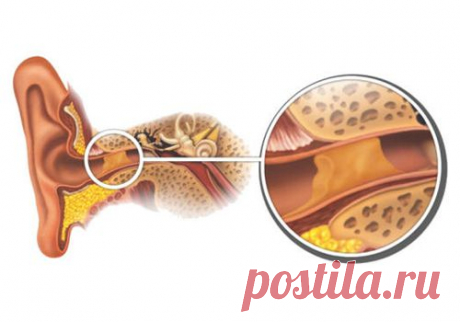Как убрать серные пробки из ушей натуральными средствами?