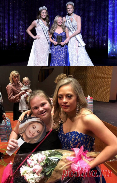 Девушка с синдромом Дауна приняла участие в конкурсе красоты за звание мисс Миннесота