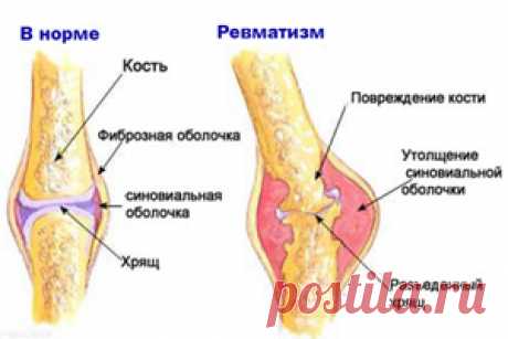 народная медицина, здоровье, травы, фитотерапия | Записи в рубрике народная медицина, здоровье, травы, фитотерапия | Дневник Вкусняшки_от_Белоснежки