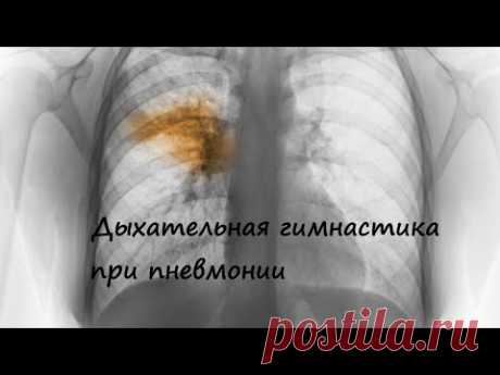 Дыхательная гимнастика при воспалении легких (пневмонии)