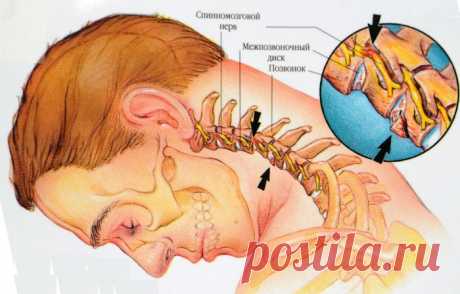 8 потрясающих упражнений от шейного остеохондроза — Сияние Жизни