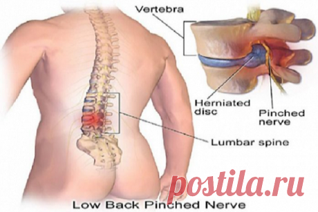 СЕКРЕТ ИЗБАВЛЕНИЯ ОТ БОЛИ В СПИНЕ НАХОДИТСЯ В ВАШИХ НОГАХ. 5 УПРАЖНЕНИЙ, КОТОРЫЕ ИСПРАВЯТ ВСЕ