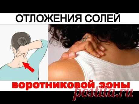 Как убрать отложение солей на шее? Простой домашний компресс