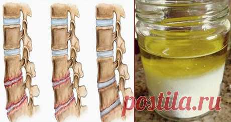 Попробуйте эту смесь — и избавитесь от боли, от которой страдали много лет! | KaifZona.Ru