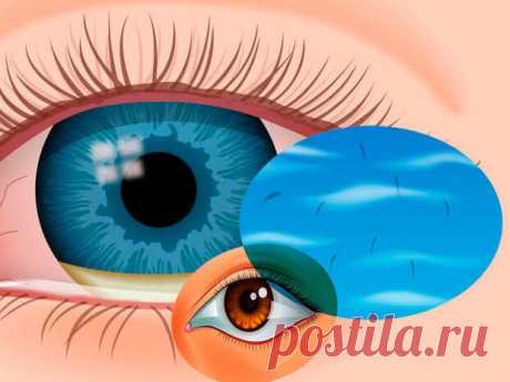 Мушки в глазах: Почему появляются и что делать?
Глазные поплавки или мушки — это пятна, движущиеся через ваше поле зрения.  Они могут выглядеть черными или серыми, волнистыми или похожими на паутину, они могут двигаться, дрейфовать или метаться, когда вы двигаете глазами.  Многие глазные поплавки вызваны возрастными изменениями в глазах.  Если глазные поплавки появляются и увеличиваются быстро или внезапно, вам следует немедленно обратиться к […]
Читай дальше на сайте. Жми подробнее ➡