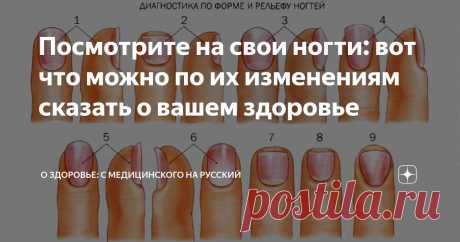 Посмотрите на свои ногти: вот что можно по их изменениям сказать о вашем здоровье Статья автора «О здоровье: с медицинского на русский » в Дзене ✍: Ногти являются придатками кожи и их патологические изменения и болезни могут быть симптомом многих заболеваний организма.