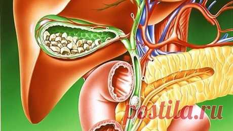 ЛЕЧИМСЯ ДОМА-ЛЕЧЕНИЕ ЖЕЛЧНОКАМЕННОЙ БОЛЕЗНИ