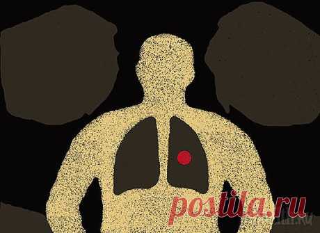 Туберкулез: что нужно знать?
В 1905 году Роберт Кох, получая Нобелевскую премию, предрек скорую победу над туберкулезом. Знаменитый микробиолог ошибся. Узнай, чем это грозит лично тебе.
