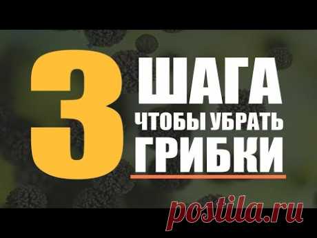 🔥 3 Метода Очищения От Грибков |  Лечение кандидоза и грибковых инфекций | Кандида. Дрожжи. Плесень