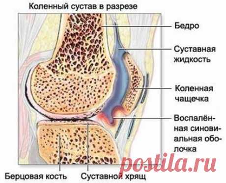 Боль в коленном суставе: причины, симптомы, лечение