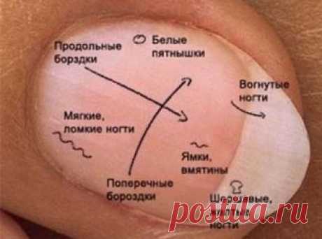 (+1) тема - Диагностика по ногтям в восточной медицине | ВСЕГДА В ФОРМЕ!