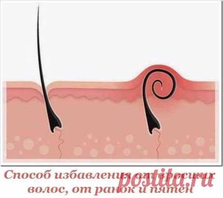 Способ избавления от вросших волос, от ранок и пятен, которые остаются после.