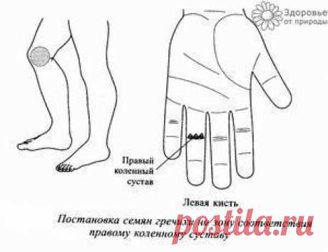 СУ-ДЖОК-ТЕРАПИЯ – &quot;&quot;&quot;ВСЯКИЕ ПОЛЕЗНОСТИ ДЛЯ ТЕБЯ!, пользователь Ольга Гужва | Группы Мой Мир