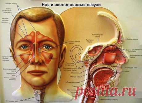 Народные средства и методы от гайморита / Абсолютное здоровье