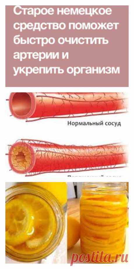 Это средство поможет быстро очистить артерии и укрепить организм - lucheedlavas.ru