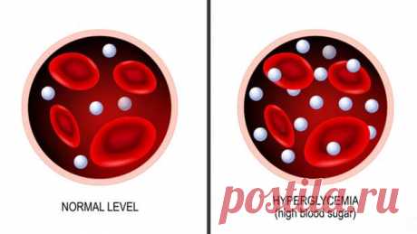 Натуральные способы контроля сахара в крови... - Познавательный сайт ,,1000 мелочей" - медиаплатформа МирТесен Преддиабед является признаком того, что человек входит в группу риска по заболеванию сахарный диабет 2-го типа. Это промежуточное состояние, при котором поджелудочная железа еще вырабатывает инсулин, но мало или в достаточном количестве, но организм уже плохо его усваивает. Как самостоятельно