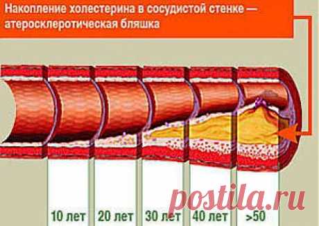 Старинный рецепт очищение сосудов от холестерина.